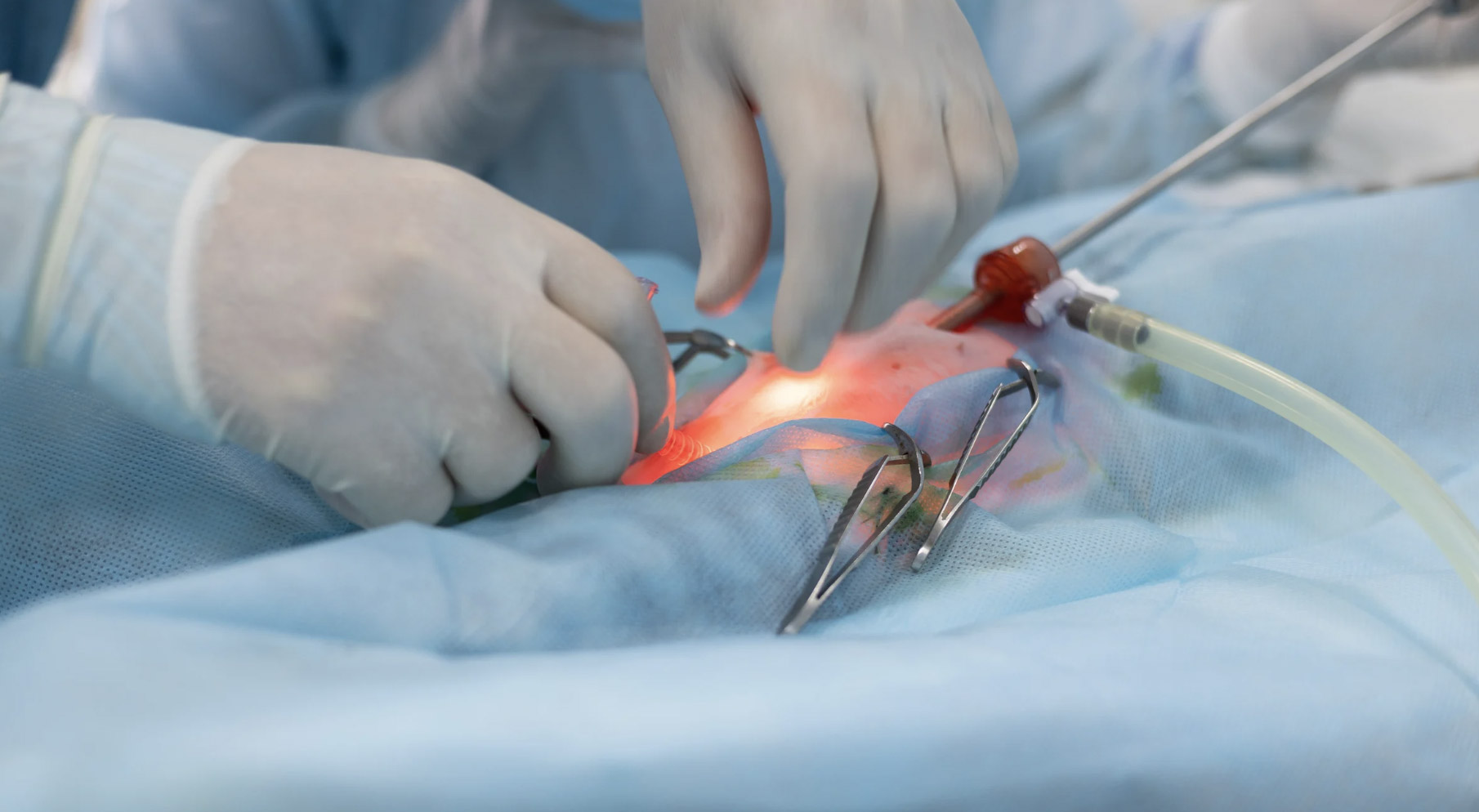 Minimally invasive spine surgery in operating room